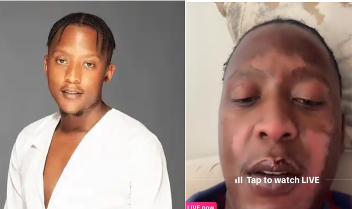 ‘The River’ Star Ontshiametse Molekoa Suffers Severe Burns in Freak Cooking Oil Accident 