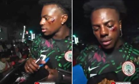 Popular livestreamer IShowSpeed reportedly came under attack by road gangsters while streaming in Nigeria.
