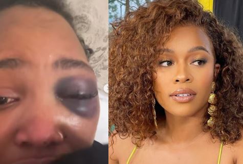 “Angry, Heartbroken and Done Keeping Quiet”: Nomzamo Mbatha’s Emotional Post Hits Mzansi Hard